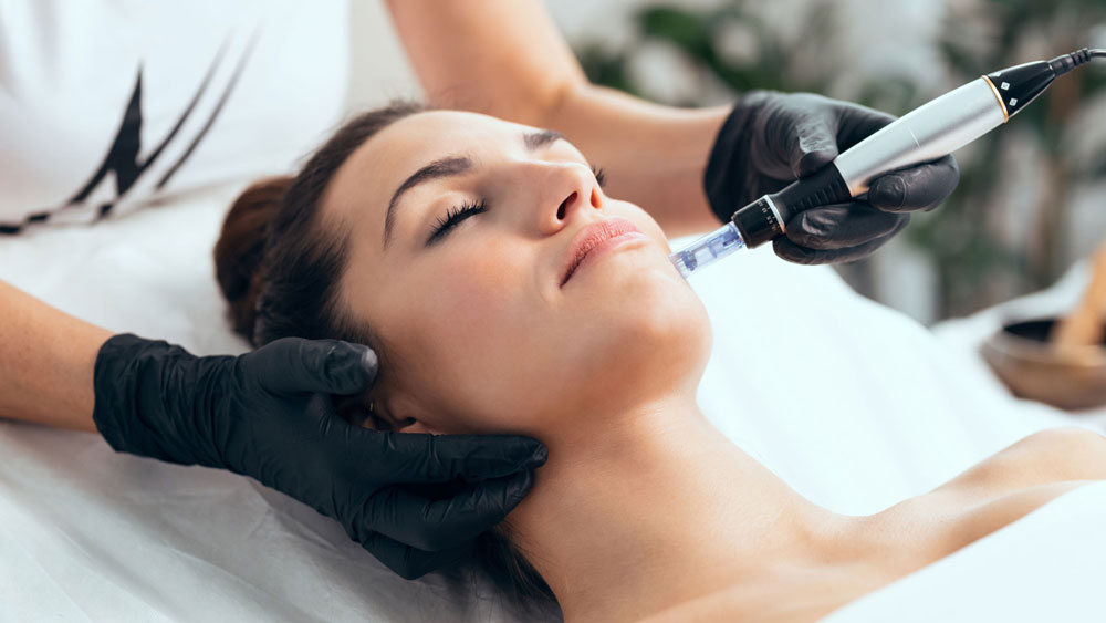 Microneedling in der YOU Clinic